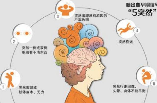 女生突发脑出血 症状是不会说英语
