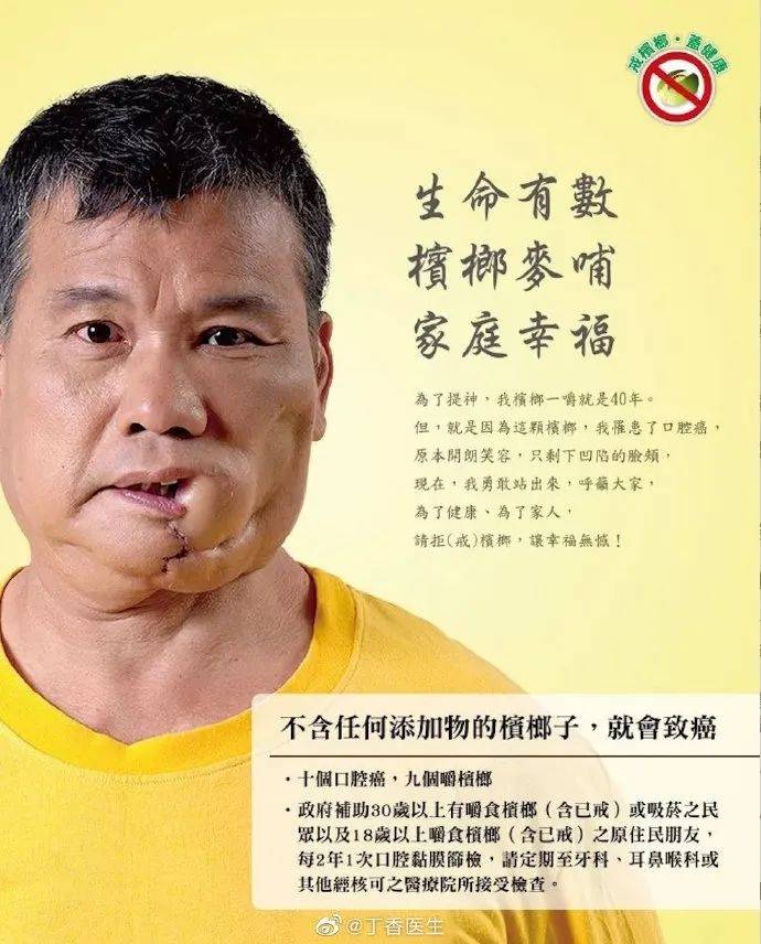 嚼槟榔20年患口腔癌