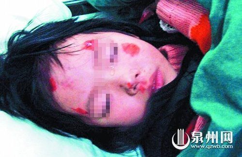 儿童遭父亲殴打致死