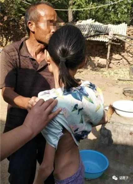 震惊！女子旅游病逝回国后心脏离奇消失，家属质疑跨国医疗黑幕
