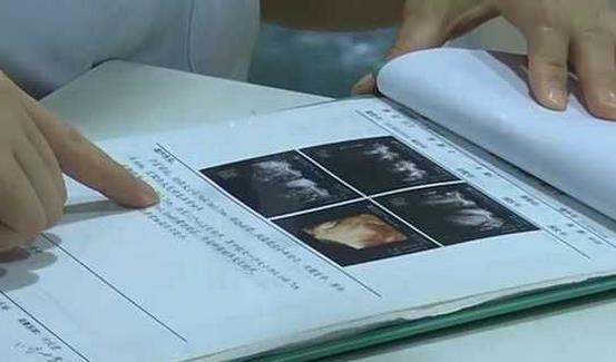震惊！25岁女孩婚前体检时才发现无子宫，医生揭露背后真相